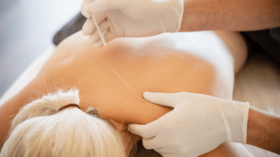 Acupuntura na Terceira Idade: Benefícios E Cuidados Especiais