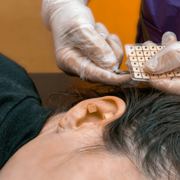 Como Funciona A Auriculoterapia