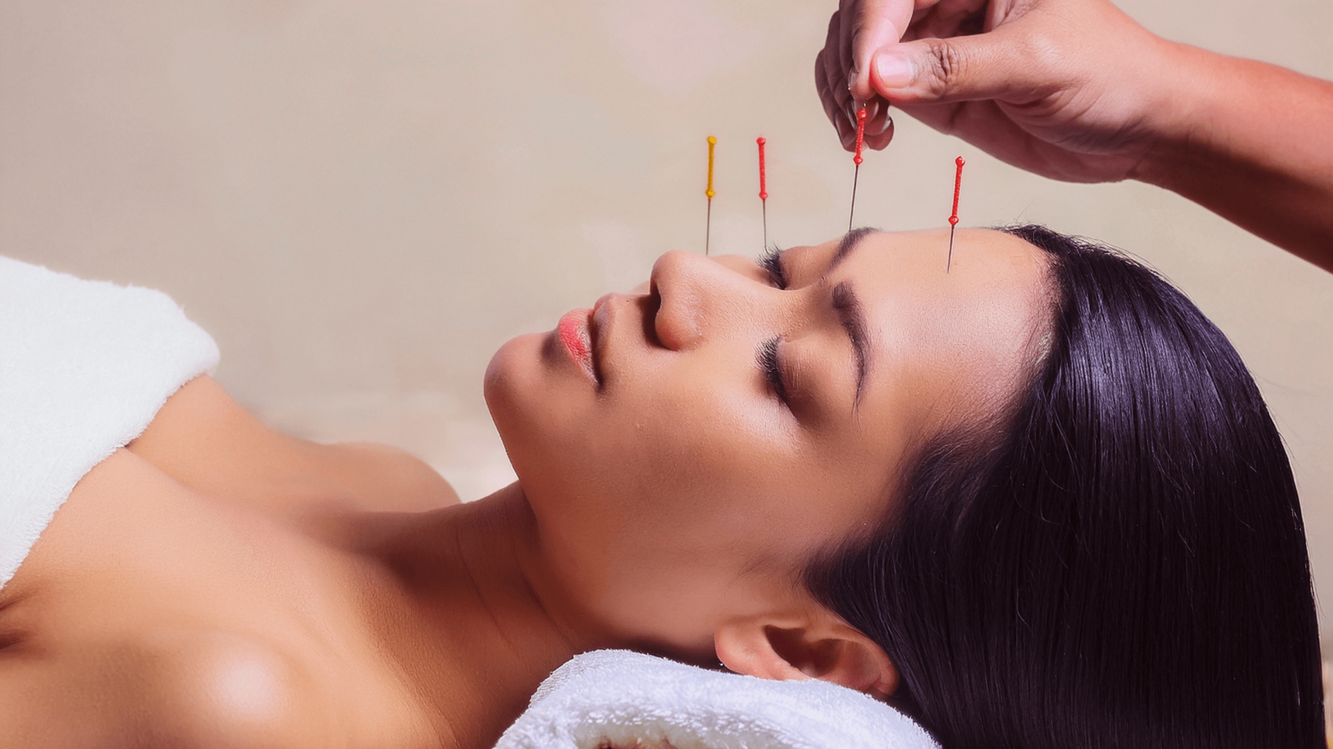 O Que Não Fazer Após Uma Sessão De Acupuntura