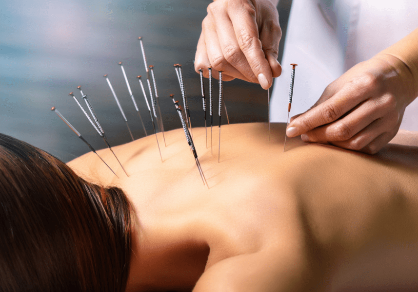 Quem Pode Se Beneficiar Da Acupuntura
