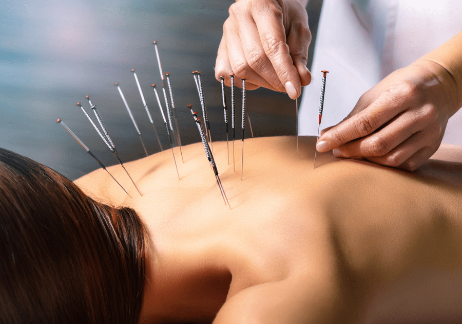 Quem Pode Se Beneficiar Da Acupuntura